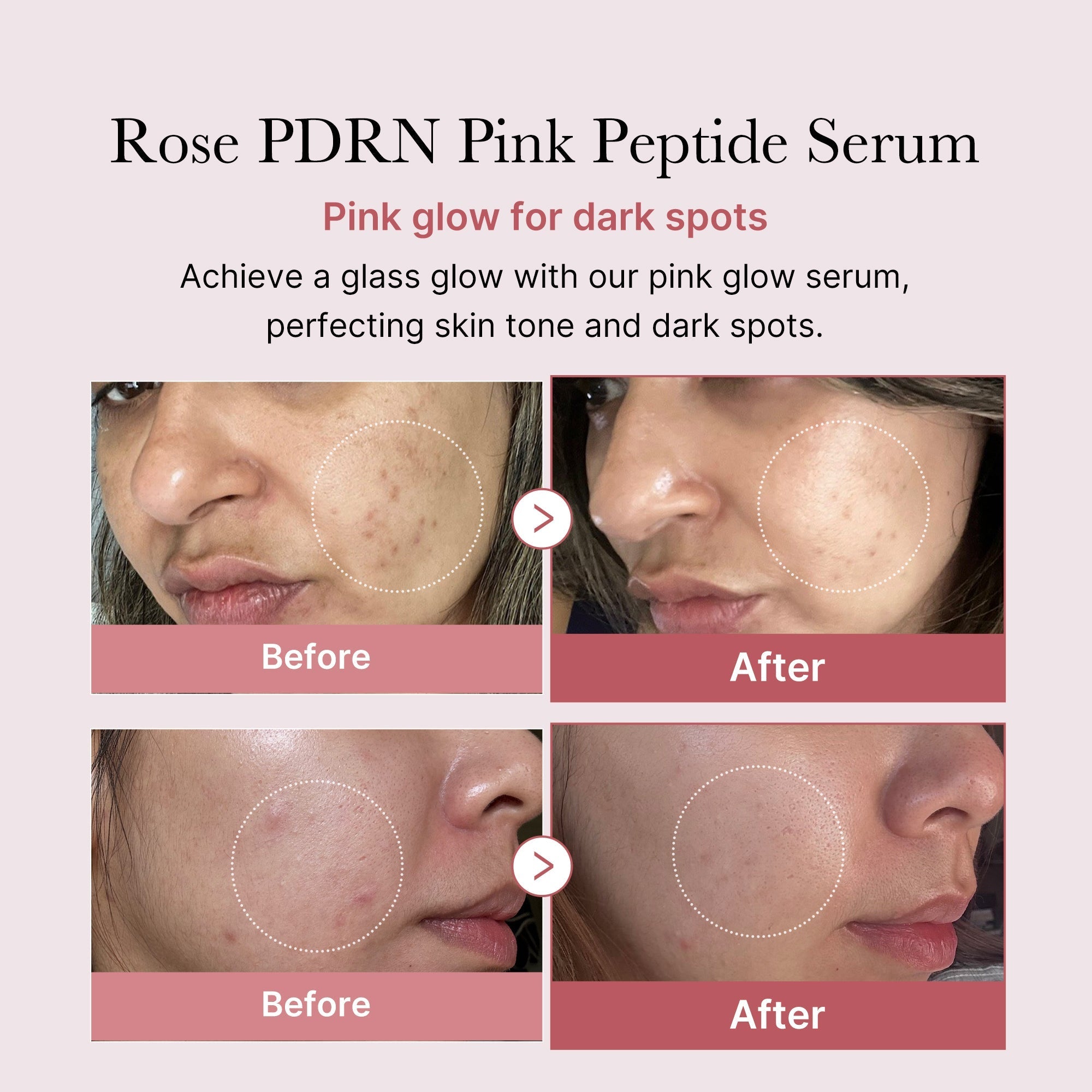 Buy Medicube PDRN Pink Peptide Serum - 30ml in Pakistan