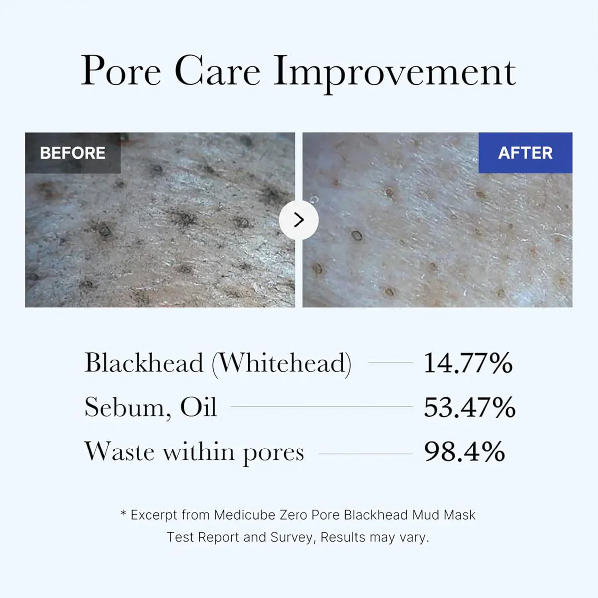 Buy MEDICUBE - Zero Pore Blackhead Mud Mask - 100G in Pakistan