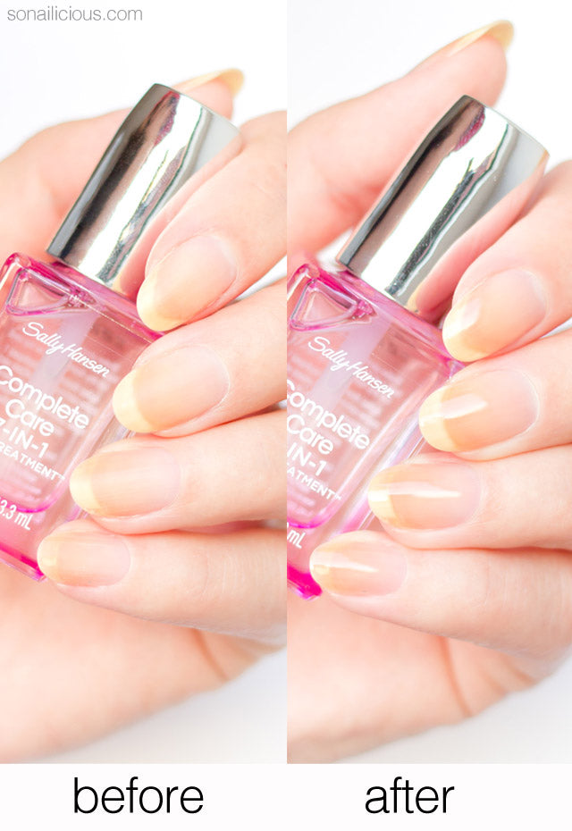 Buy Sally Hansen Complete Care 7 in 1 Nail Treatment - 13.3ml in Pakistan
